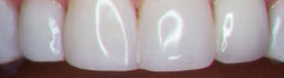 case32-5b9fe2b8a6471