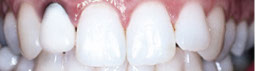 case4-5b9fe412d83c6