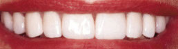 case52-5b9fe34e5390b
